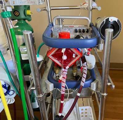 ECMO-1.jpeg